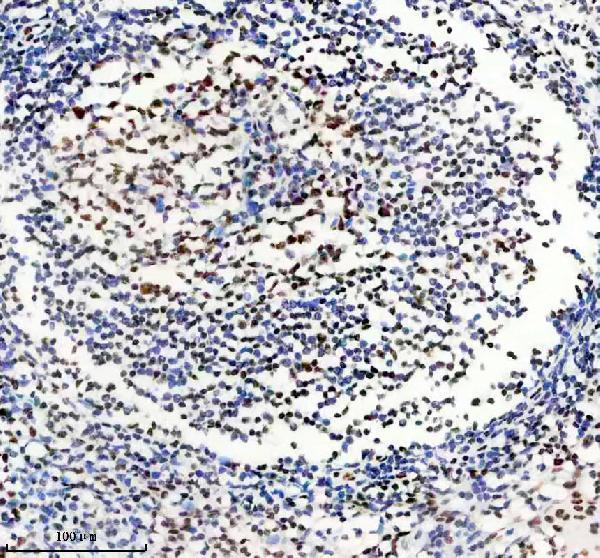 m02931 1 matr3 primary antibodies ihc testing 6