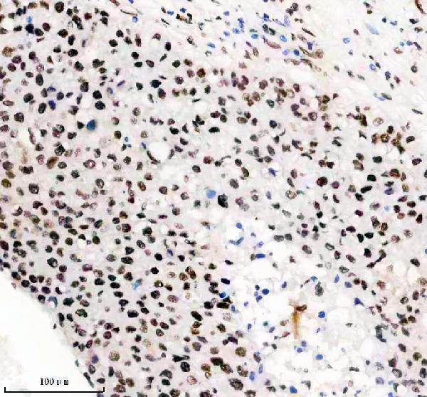 m02931 1 matr3 primary antibodies ihc testing 7