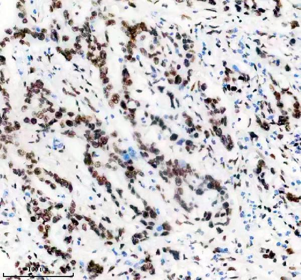 m02931 1 matr3 primary antibodies ihc testing 8