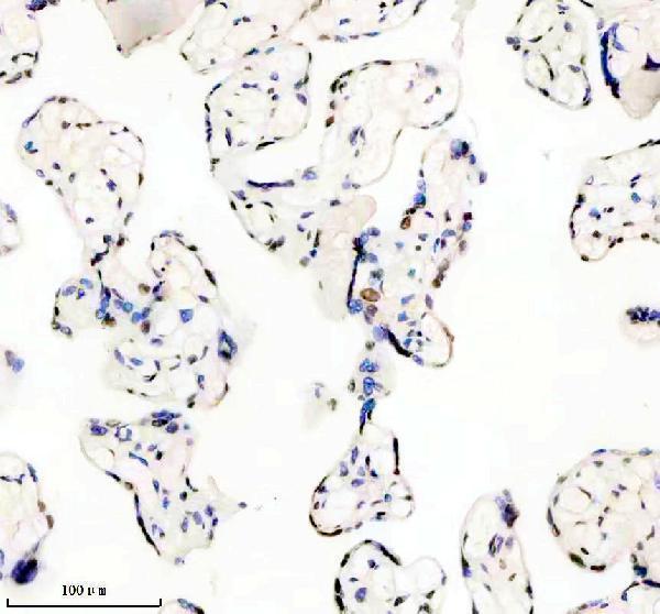 m02931 1 matr3 primary antibodies ihc testing 9