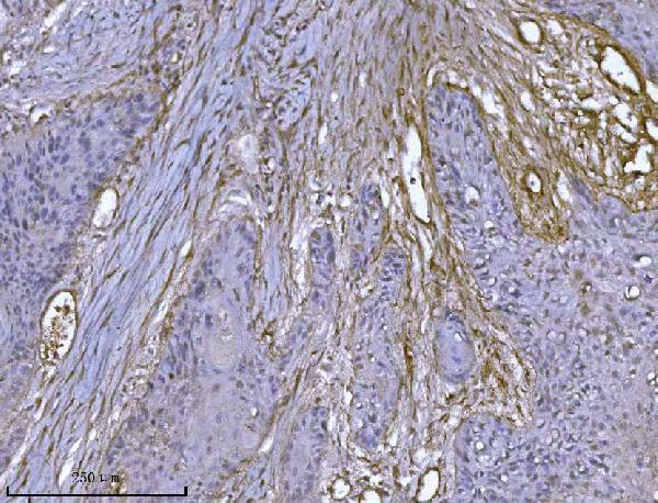  IHC analysis of Integrin linked ILK using anti-Integrin linked ILK antibody (M02932-2)