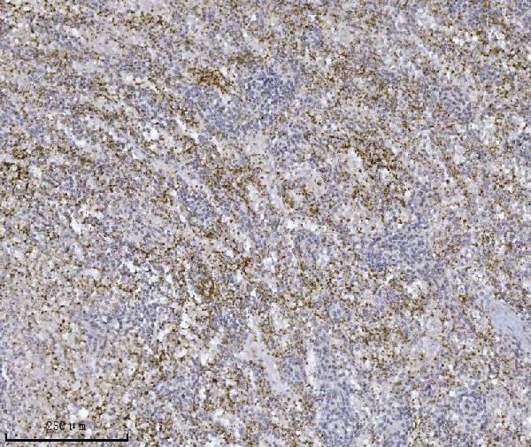  IHC analysis of Integrin linked ILK using anti-Integrin linked ILK antibody (M02932-2)