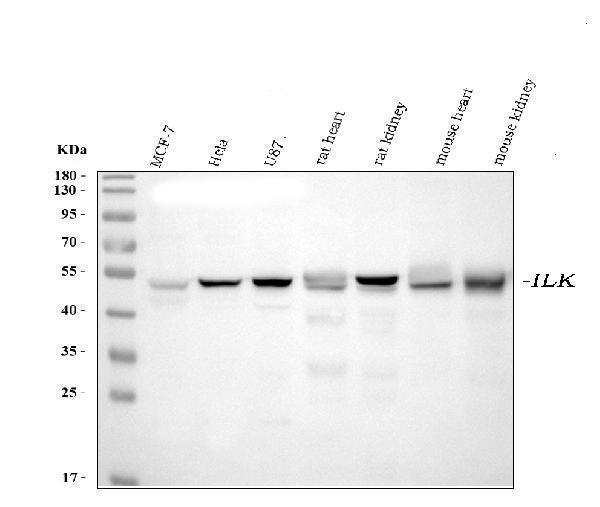  Western blot analysis of Integrin linked ILK using anti-Integrin linked ILK antibody (M02932-2)