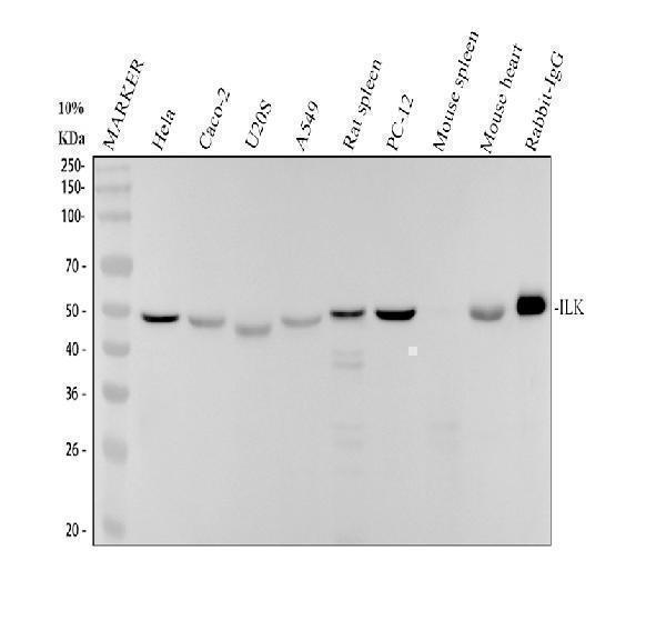 Western blot analysis of ILK/Integrin Linked using anti-ILK/Integrin Linked antibody (M02932)