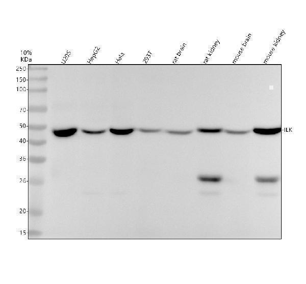 Western blot analysis of ILK using anti-ILK antibody (M02932)