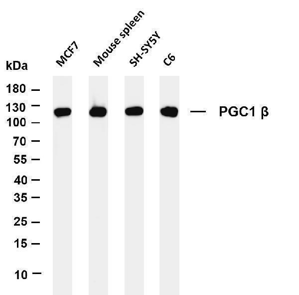 Various whole cell lysates were separated by 4-20% SDS-PAGE, and the membrane was blotted with anti-PGC1 β antibody
