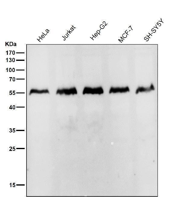 m02935 wb7