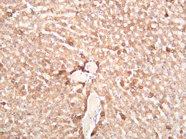 m02937 1 atp5b primary antibodies ihc testing 1