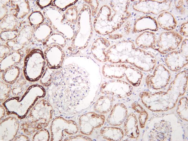 m02937 1 atp5b primary antibodies ihc testing 2