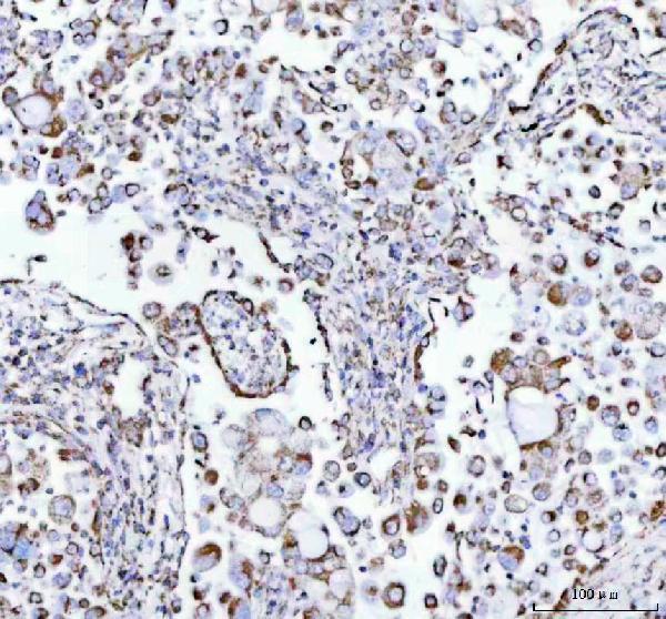 m02937 atpb primary antibodies ihc testing 2
