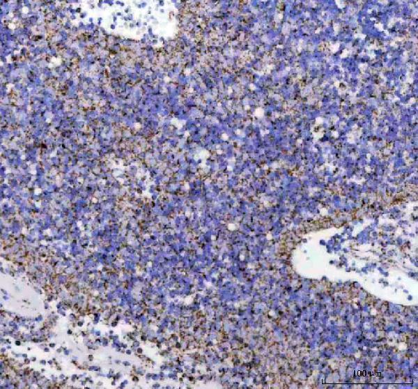m02937 atpb primary antibodies ihc testing 3
