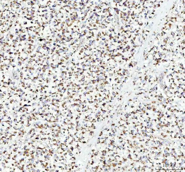 m02937 atpb primary antibodies ihc testing 4