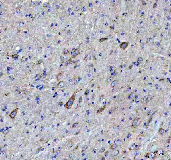 m02937 atpb primary antibodies ihc testing 5