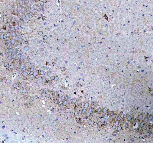 m02937 atpb primary antibodies ihc testing 6