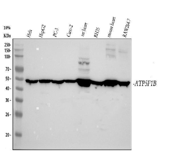 m02937 atpb primary antibodies wb testing 1