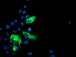 m02938 anti lgals3bp mouse monoclonal antibody clone id oti3g8 if testing 8