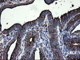 m02938 anti lgals3bp mouse monoclonal antibody clone id oti3g8 ihc testing 4
