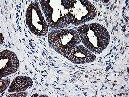 m02938 anti lgals3bp mouse monoclonal antibody clone id oti3g8 ihc testing 5