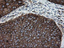 m02938 anti lgals3bp mouse monoclonal antibody clone id oti3g8 ihc testing 6