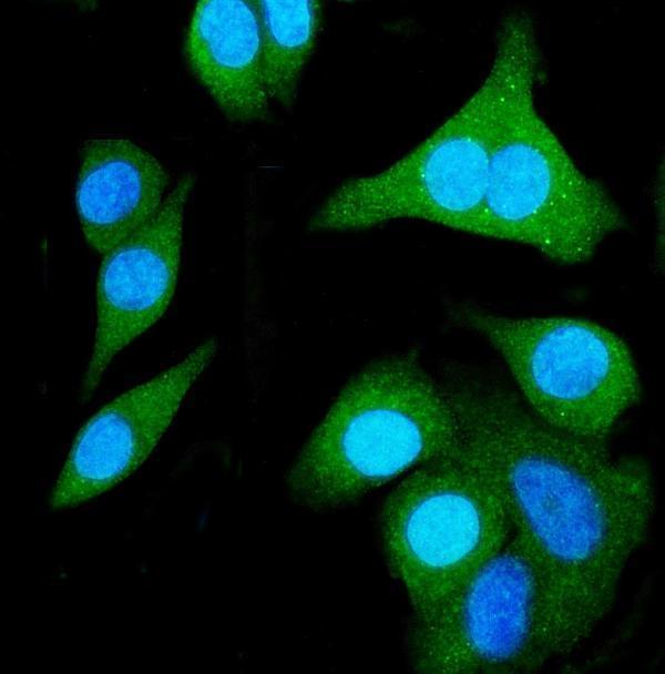  IF analysis of SHMT1 using anti-SHMT1 antibody (M02944)