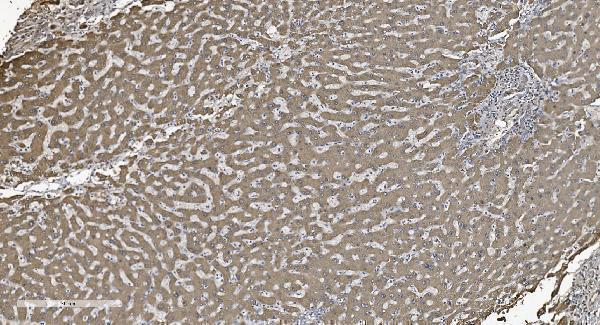  IHC analysis of SHMT1 using anti-SHMT1 antibody (M02944)