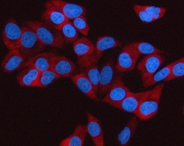  IF analysis of Sterol carrier protein 2 using anti-Sterol carrier protein 2 antibody (M02947-1)