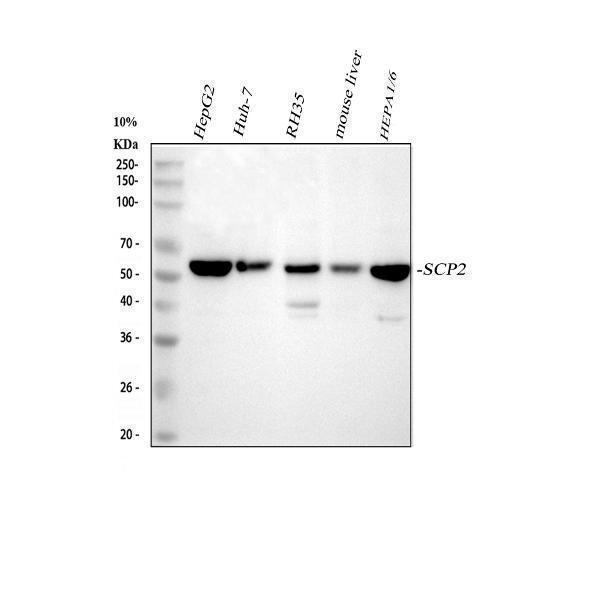  Western blot analysis of Sterol carrier protein 2 using anti-Sterol carrier protein 2 antibody (M02947-1)