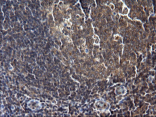 Immunohistochemical staining of paraffin-embedded Human lymph node tissue within the normal limits using anti-SCP2 mouse monoclonal antibody