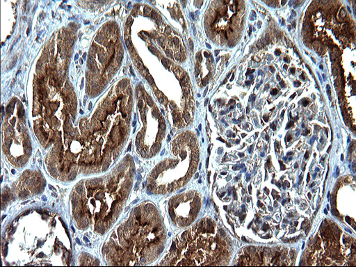 m02947 anti sterol carrier protein 2 scp2 mouse monoclonal antibody clone id oti1e4 ihc testing 4