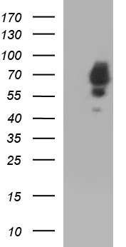 HEK293T cells were transfected with the pCMV6-ENTRY control (Left lane) or pCMV6-ENTRY SCP2 (Right lane) cDNA for 48 hrs and lysed