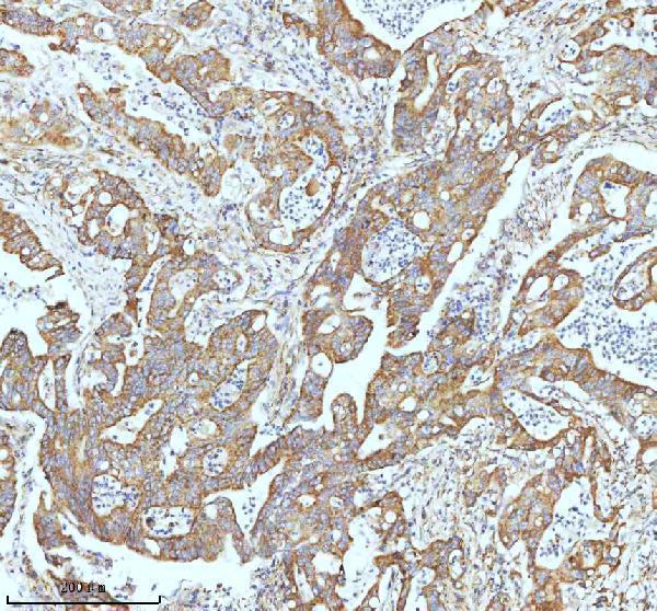 m02948 2 gclm primary antibodies ihc testing 10