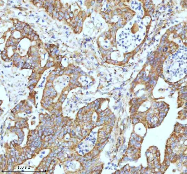m02948 2 gclm primary antibodies ihc testing 11