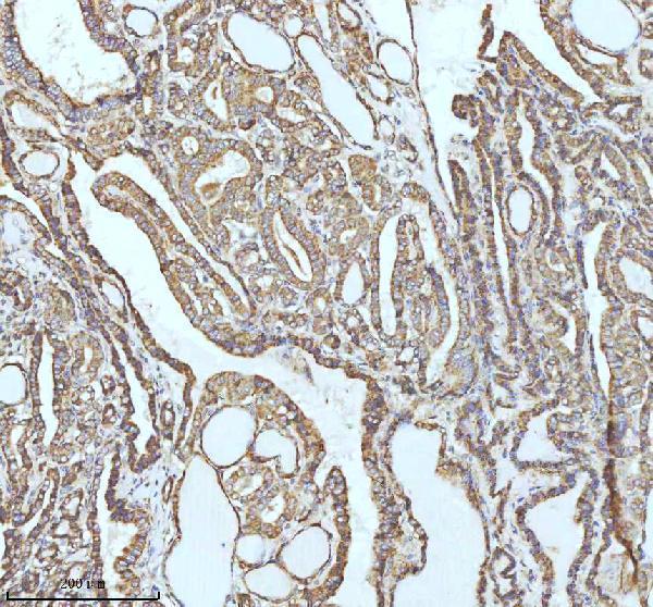 m02948 2 gclm primary antibodies ihc testing 12