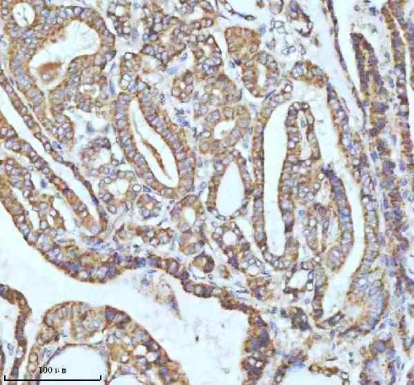 m02948 2 gclm primary antibodies ihc testing 13