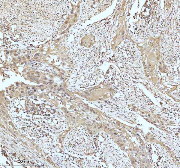 m02948 2 gclm primary antibodies ihc testing 14