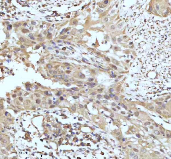m02948 2 gclm primary antibodies ihc testing 15