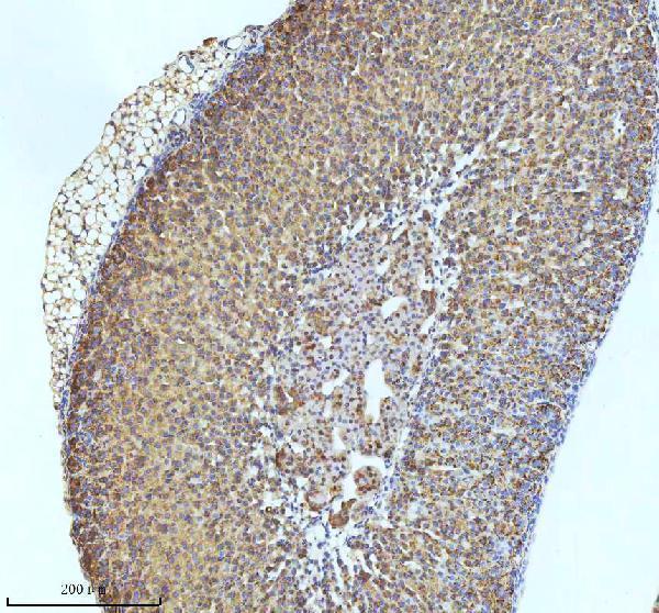 m02948 2 gclm primary antibodies ihc testing 16