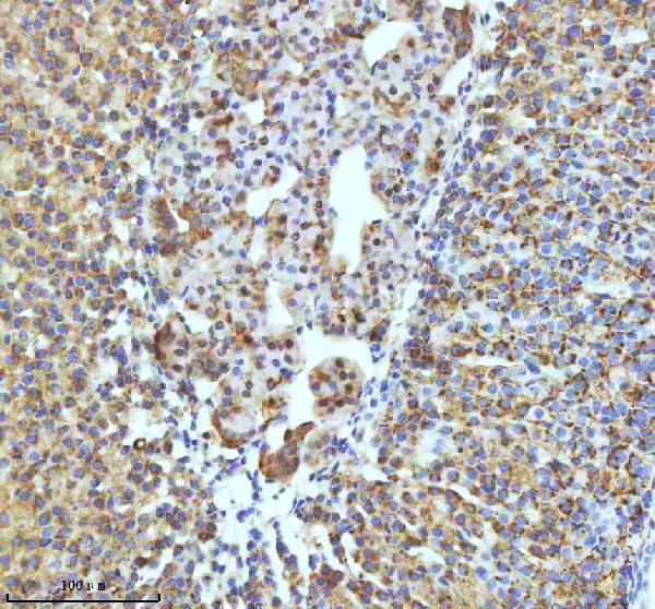 m02948 2 gclm primary antibodies ihc testing 17