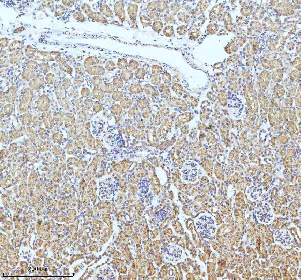m02948 2 gclm primary antibodies ihc testing 18
