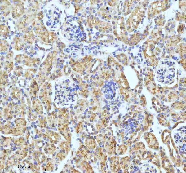 m02948 2 gclm primary antibodies ihc testing 19