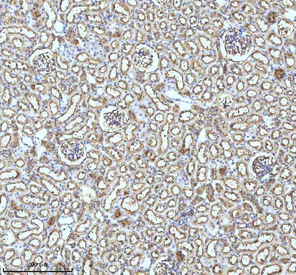 m02948 2 gclm primary antibodies ihc testing 20
