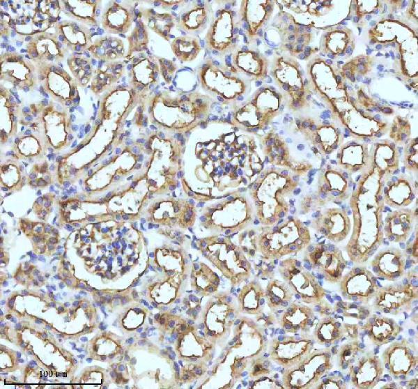 m02948 2 gclm primary antibodies ihc testing 21
