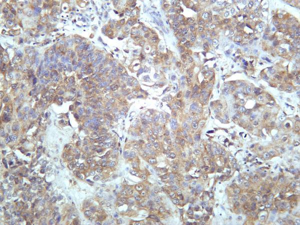 m02948 3 gclm primary antibodies ihc testing 4
