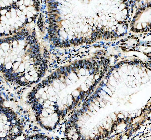 m02949 kat6a primary antibodies ihc testing 1