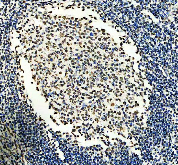 m02949 kat6a primary antibodies ihc testing 2