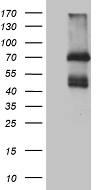 HEK293T cells were transfected with the pCMV6-ENTRY control (Left lane) or pCMV6-ENTRY IL2RB (Right lane) cDNA for 48 hrs and lysed