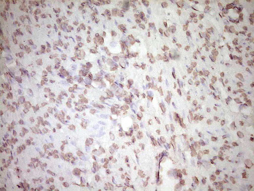 Immunohistochemical staining of paraffin-embedded Human endometrium tissue within the normal limits using anti-PLAT mouse monoclonal antibody