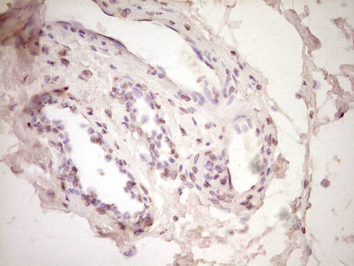 Immunohistochemical staining of paraffin-embedded Human bladder tissue within the normal limits using anti-PLAT mouse monoclonal antibody