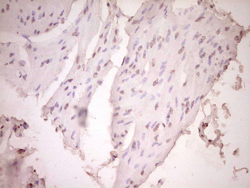 m02965 1 anti plat mouse monoclonal antibody clone id oti3h3 ihc testing 5