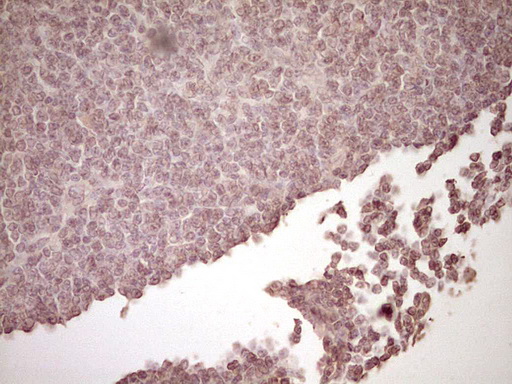 m02965 1 anti plat mouse monoclonal antibody clone id oti3h3 ihc testing 6